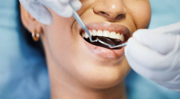 Best Broken Tooth Emergency  in Hope, AR